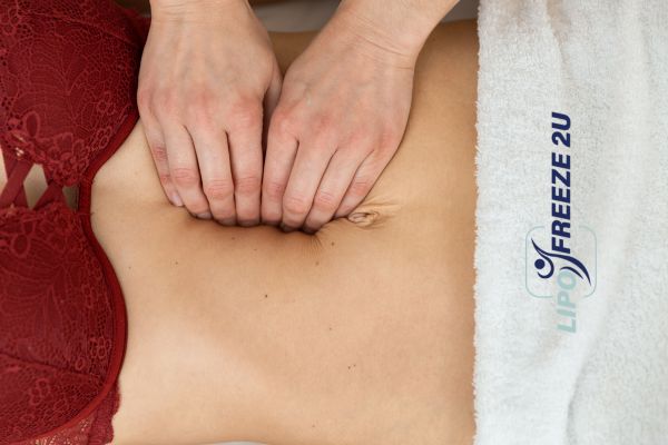 diastasis recti treatment Walsall