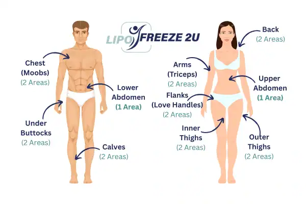 Areas you can have fat freezing treatment Walsall