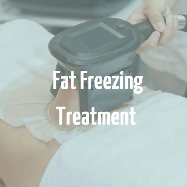 fat freezing treatment Walsall