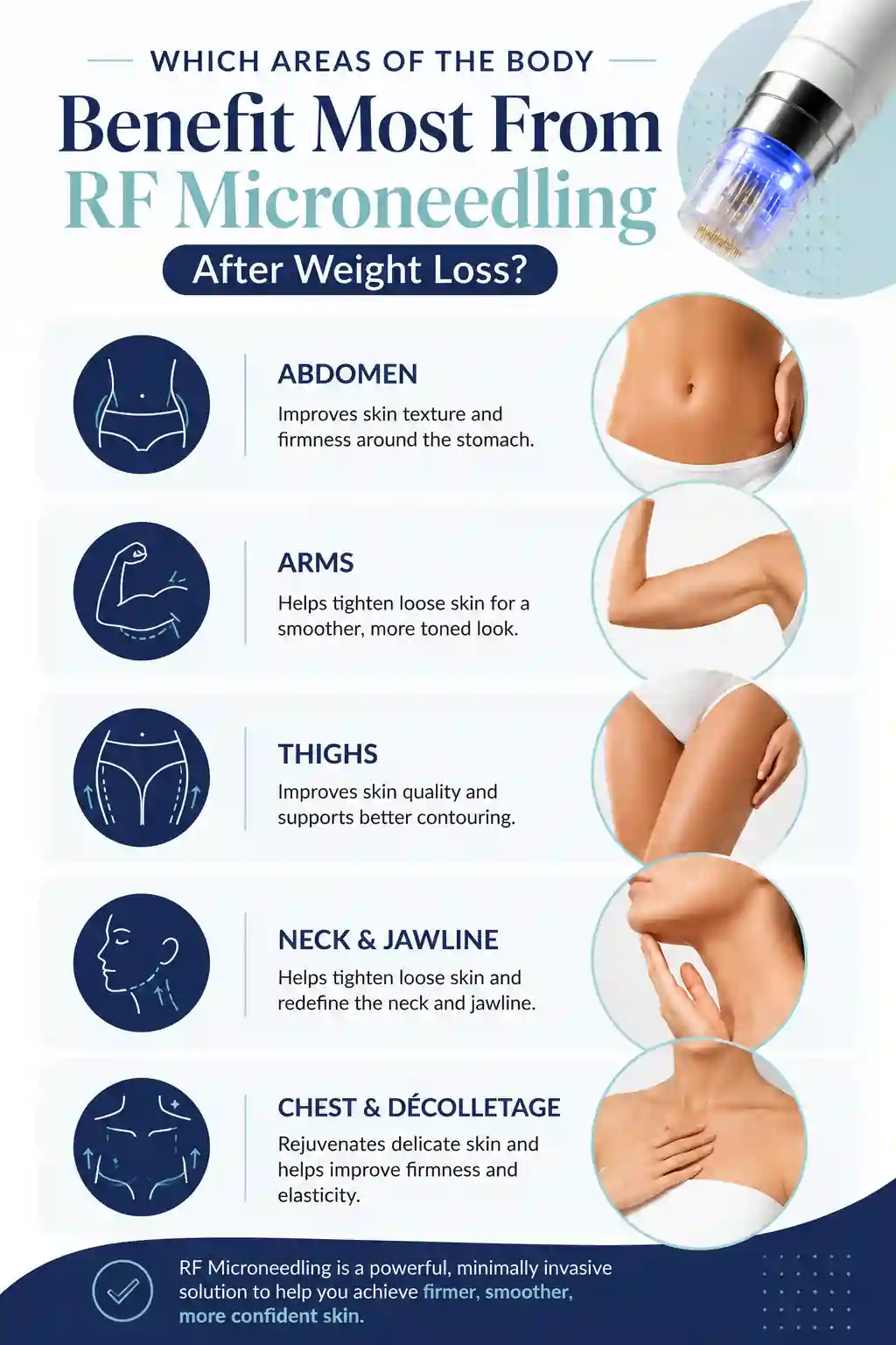 Which Areas of the Body Benefit Most From RF Microneedling After Weight Loss Walsall